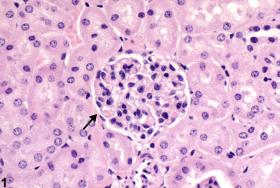 Image of glomerulus metaplasia in the kidney from a female B6C3F1 mouse in a subchronic study