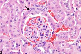 Kidney, Glomerulus - Metaplasia - Nonneoplastic Lesion Atlas