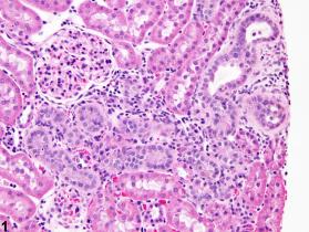 Image of nephropathy, chronic progressive in the kidney from a male F344/N rat in a subchronic study