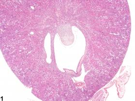 Image of renal pelvis dilation in the kidney from a male B6C3F1 mouse in a chronic study