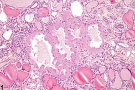 Image of renal tubule hypertrophy in the kidney from a male F344/N rat in a chronic study