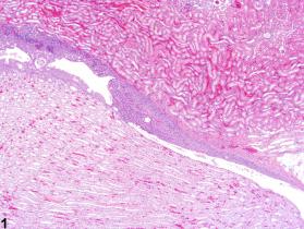 Image of urothelium hyperplasia in the kidney from a male F344/N rat in a chronic study