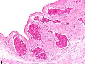 Image of angiectasis in the urinary bladder from a female B6C3F1 mouse in a chronic study