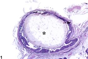 Image of calculus in the urinary bladder from a male F344/N rat in a chronic study