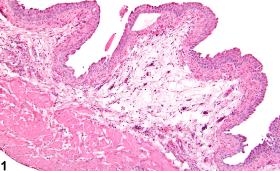 Image of edema in the urinary bladder from a female B6C3F1 mouse in a chronic study