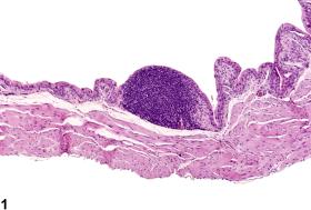 Image of infiltrative cellular, lymphocyte in the urinary bladder from a female B6C3F1 mouse in a chronic study