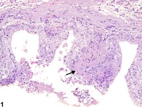 Image of necrosis in the urinary bladder from a male F344/N rat in a chronic study