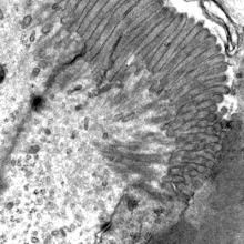 Normal small intestine