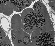 Normal pancreas