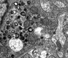 Normal adrenal gland