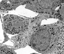 Normal pituitary gland
