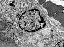Normal thyroid gland