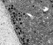 Normal prostate