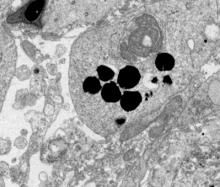 Normal testis
