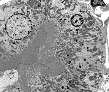 EM of kidney