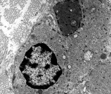 Normal urinary bladder EM