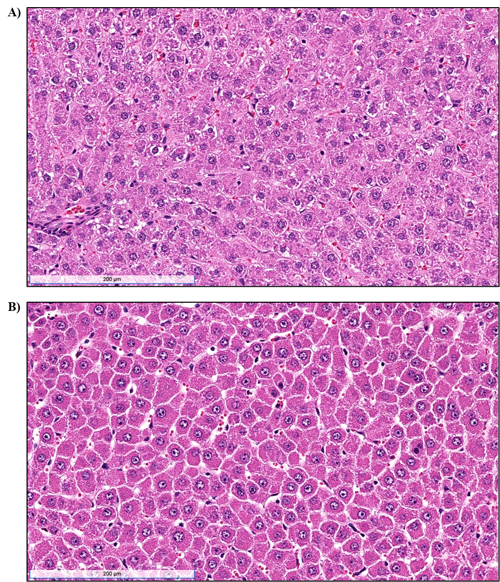 Figure&nbsp;8. Representative Images of a Control Liver and Hepatocyte Hypertrophy in the Liver of Male Rats in the Two-week Gavage Study of tBuPrOcEst-BZT (H&E)