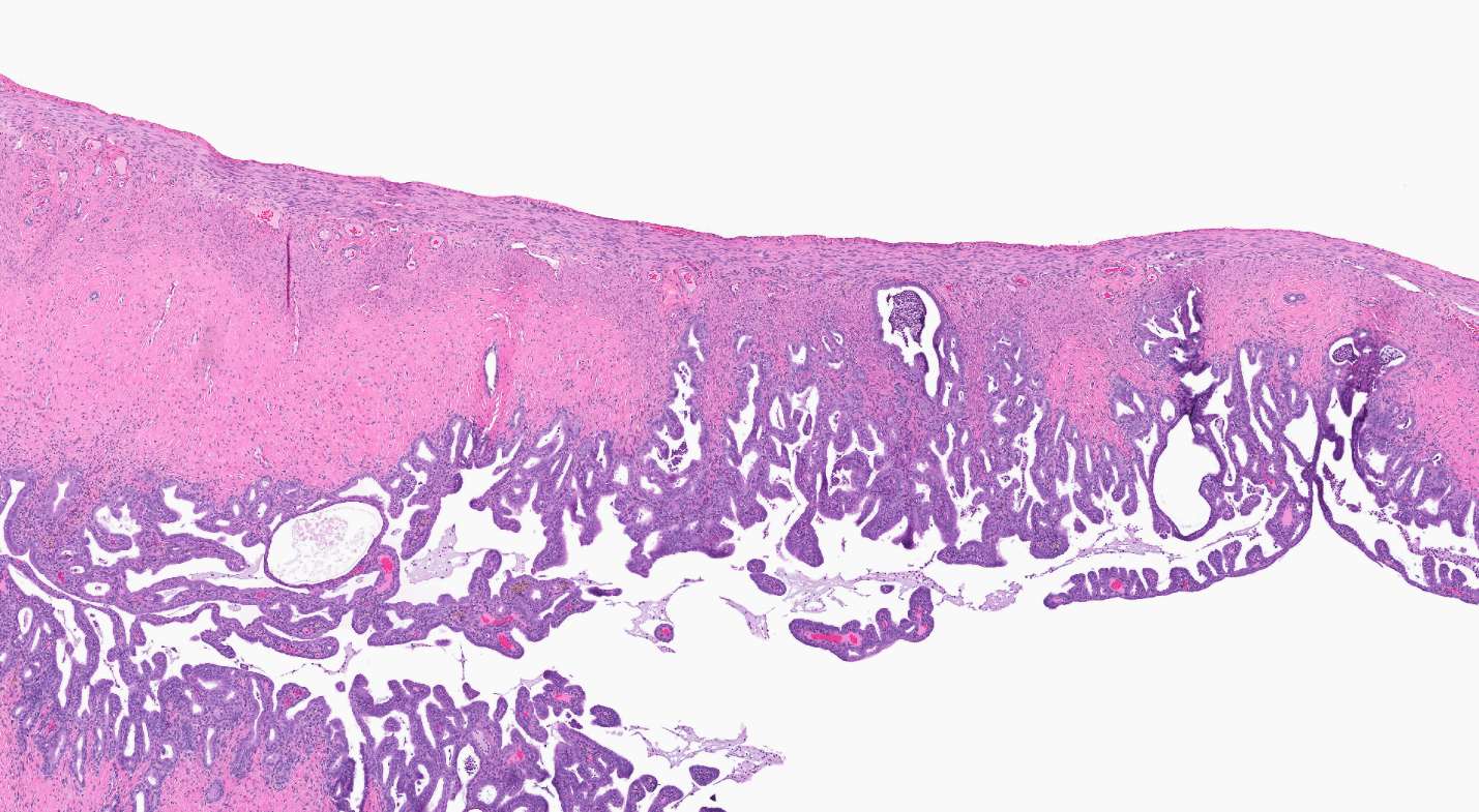 Figure 8. Representative Image of Cystic Endometrial Hyperplasia in the Uterus of a Female Rat in the Perinatal and Two-year Feed Study of Tris(chloropropyl) Phosphate (H&E)