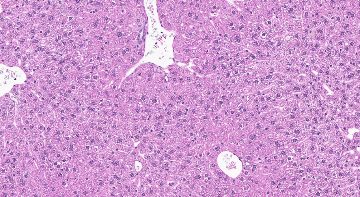 Figure 14. Representative Image of Cytoplasmic Alteration of Hepatocytes in the Liver of a Female Mouse in the Two-year Feed Study of Tris(chloropropyl) Phosphate (H&E)