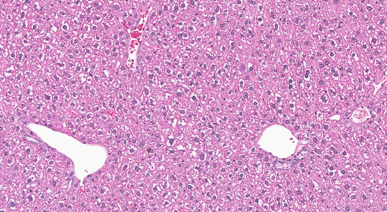 Figure 15. Representative Image of Control Liver in a Female Mouse in the Two-year Feed Study of Tris(chloropropyl) Phosphate (H&E)