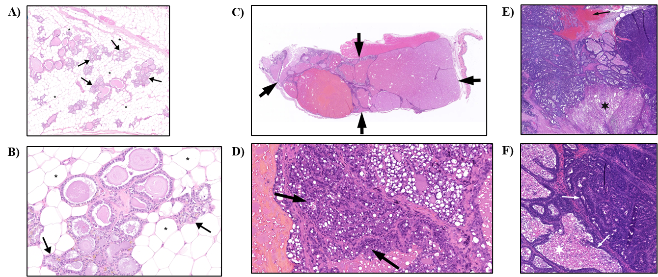 Figure 4. Representative Images of Control Mammary Gland and Adenoma and Adenocarcinoma in the Mammary Gland in Female Rats in the Two-year Inhalation Study of α-Pinene (H&E)