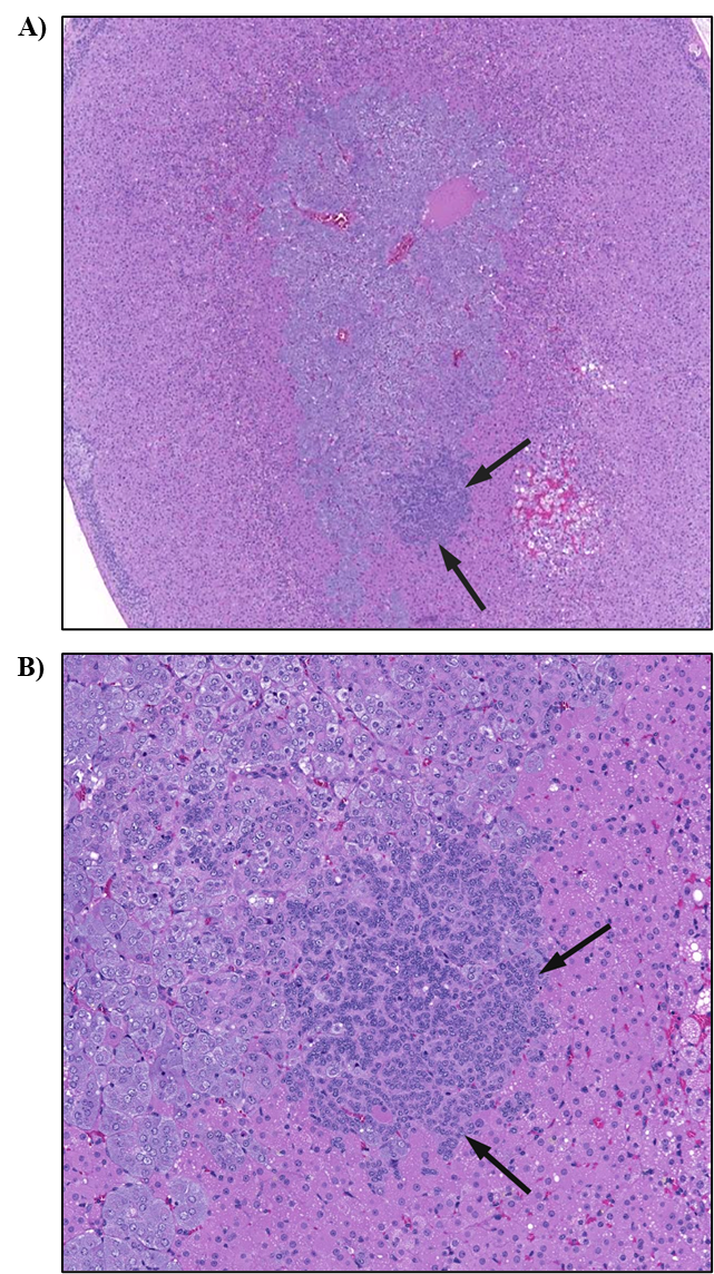 Figure 8. Representative Images of Focal Hyperplasia in the Adrenal Gland in a Male Rat in the Two-year Inhalation Study of α-Pinene (H&E)