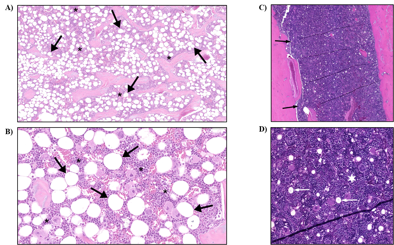Figure 9. Representative Images of Control Bone Marrow and Hypercellularity in the Bone Marrow in a Female Rat in the Two-year Inhalation Study of α-Pinene (H&E)
