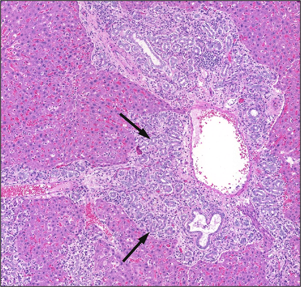 Figure 10. Representative Image of Bile Duct Hyperplasia in the Liver in a Male Rat in the Two-year Inhalation Study of α-Pinene (H&E)