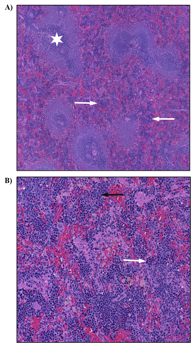 Figure 11. Representative Images of Increased Extramedullary Hematopoiesis in the Spleen in a Female Rat in the Two-year Inhalation Study of α-Pinene (H&E)