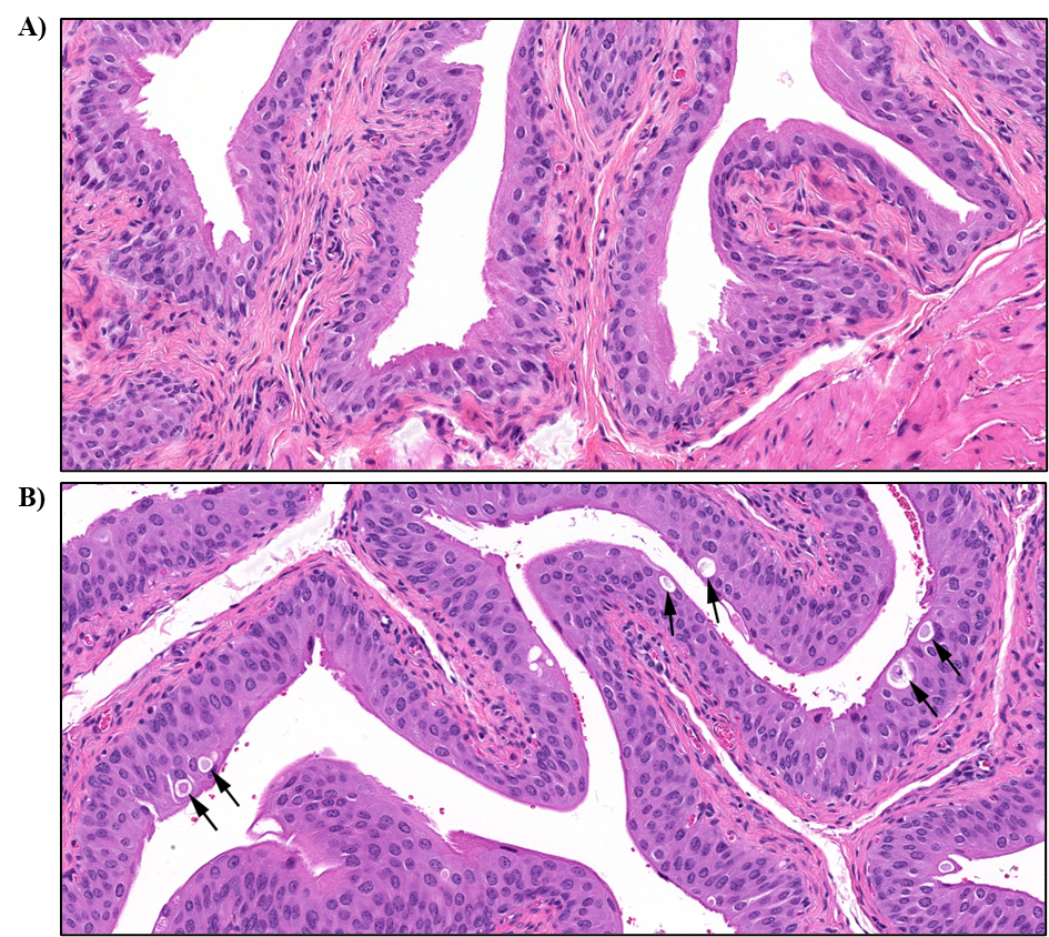 Figure 12. Representative Images of Control Urothelium and Single Cell Death in the Urothelium of the Urinary Bladder in a Male B6C3F1/N Mouse in the Three-month Inhalation Study of α-Pinene (H&E)