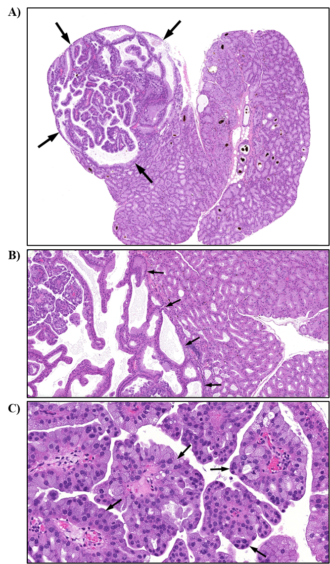 Figure 15. Representative Images of Adenoma in the Harderian Gland in a Female Mouse in the Two-year Inhalation Study of α-Pinene (H&E)