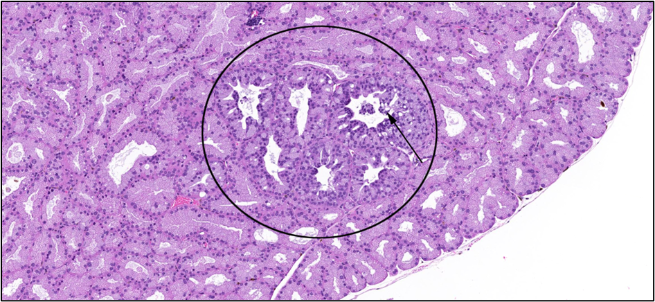 Figure 17. Representative Image of Focal Hyperplasia in the Harderian Gland in a Male Mouse in the Two-year Inhalation Study of α-Pinene (H&E)
