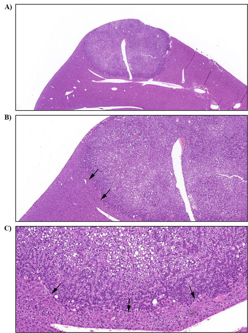 Figure 18. Representative Images of Hepatocellular Adenoma in the Liver in a Male Mouse in the Two-year Inhalation Study of α-Pinene (H&E)
