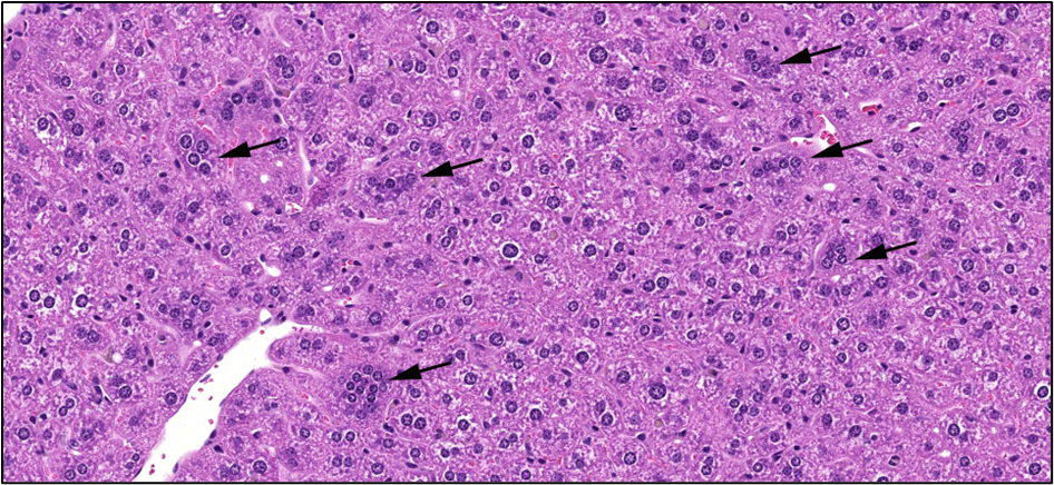 Figure 20. Representative Image of Multinucleated Hepatocytes in the Liver in a Male Mouse in the Two-year Inhalation Study of α-Pinene (H&E)