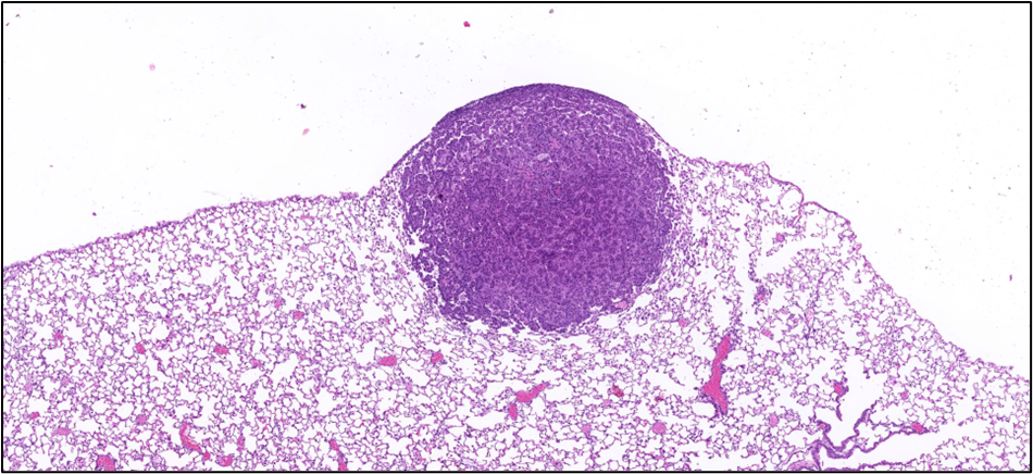 Figure 21. Representative Image of Alveolar/Bronchiolar Adenoma in the Lung of a Female Mouse in the Two-year Inhalation Study of α-Pinene (H&E)