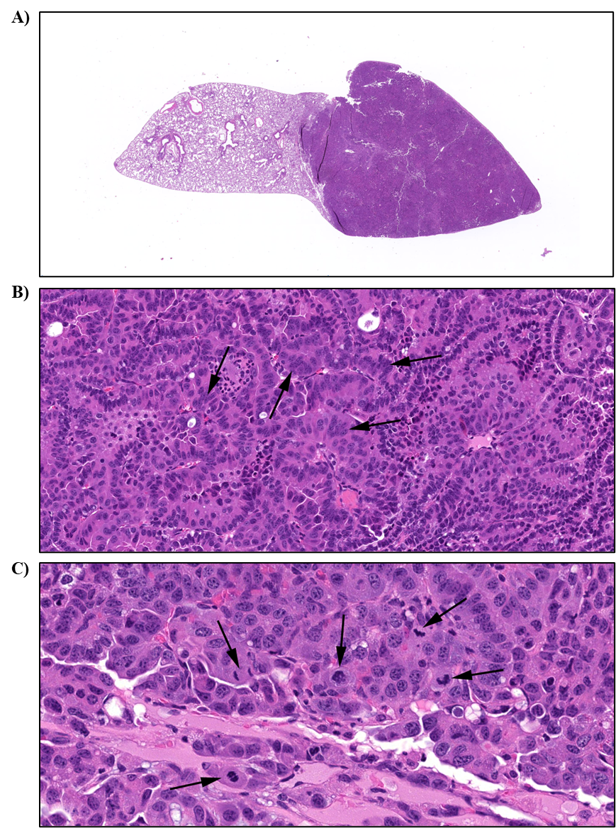 Figure 22. Representative Images of Alveolar/Bronchiolar Carcinoma in the Lung of a Female Mouse in the Two-year Inhalation Study of α-Pinene (H&E)