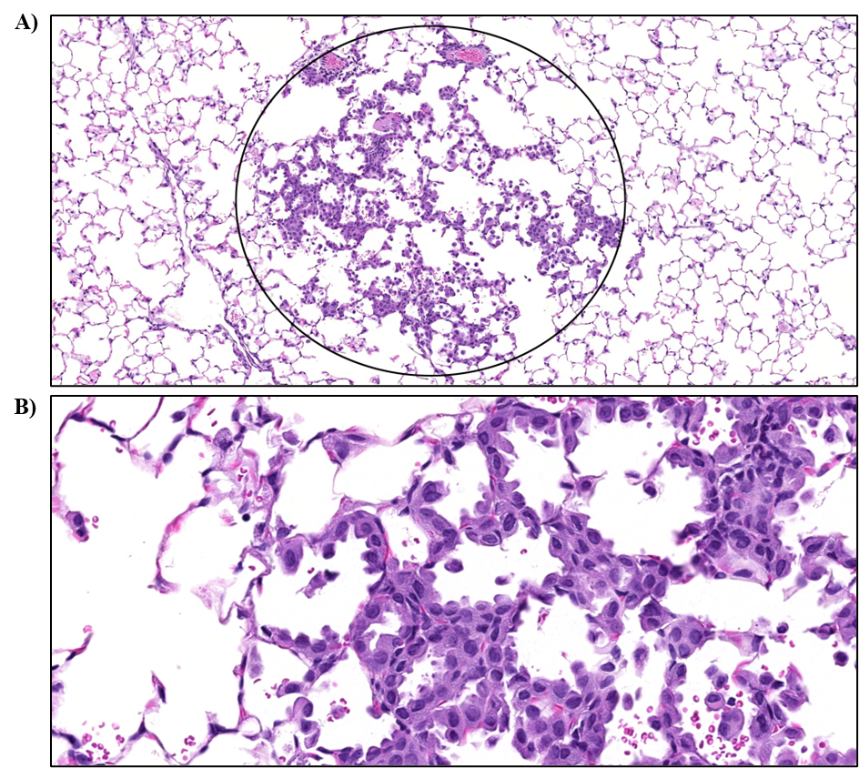 Figure 23. Representative Images of Alveolar/Bronchiolar Epithelium Hyperplasia in the Lung of a Male Mouse in the Two-year Inhalation Study of α-Pinene (H&E)