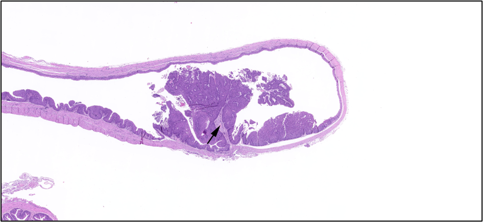 Figure 25. Representative Image of Papilloma in the Urinary Bladder of a Male Mouse in the Two-year Inhalation Study of α-Pinene (H&E)