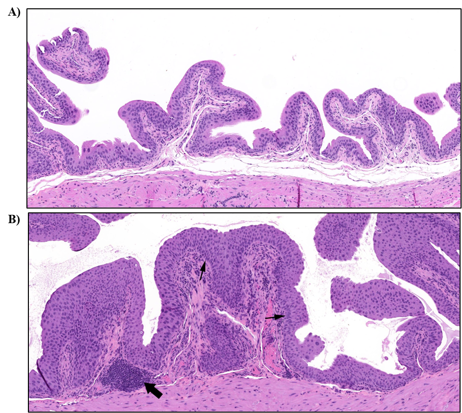 Figure 26. Representative Images of Control Urothelium and Diffuse Hyperplasia in the Bladder of a Male Mouse in the Two-year Inhalation Study of α-Pinene (H&E)