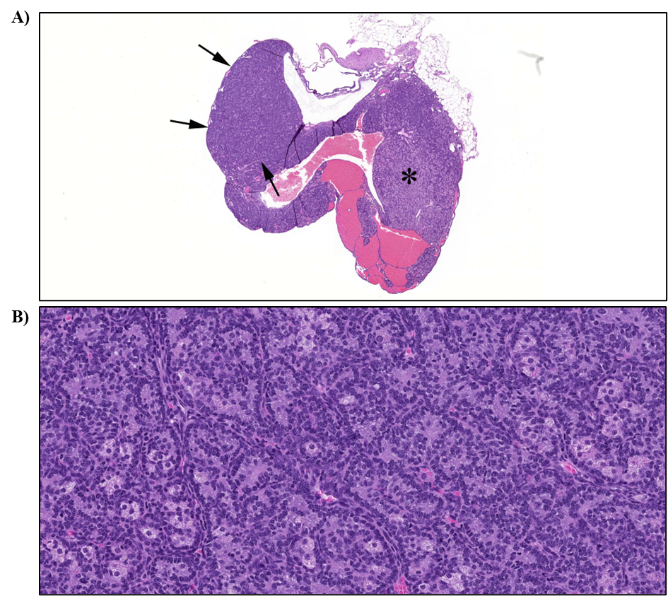 Figure 27. Representative Images of Tubulostromal Adenoma in the Ovary of a Female Mouse in the Two-year Inhalation Study of α-Pinene (H&E)