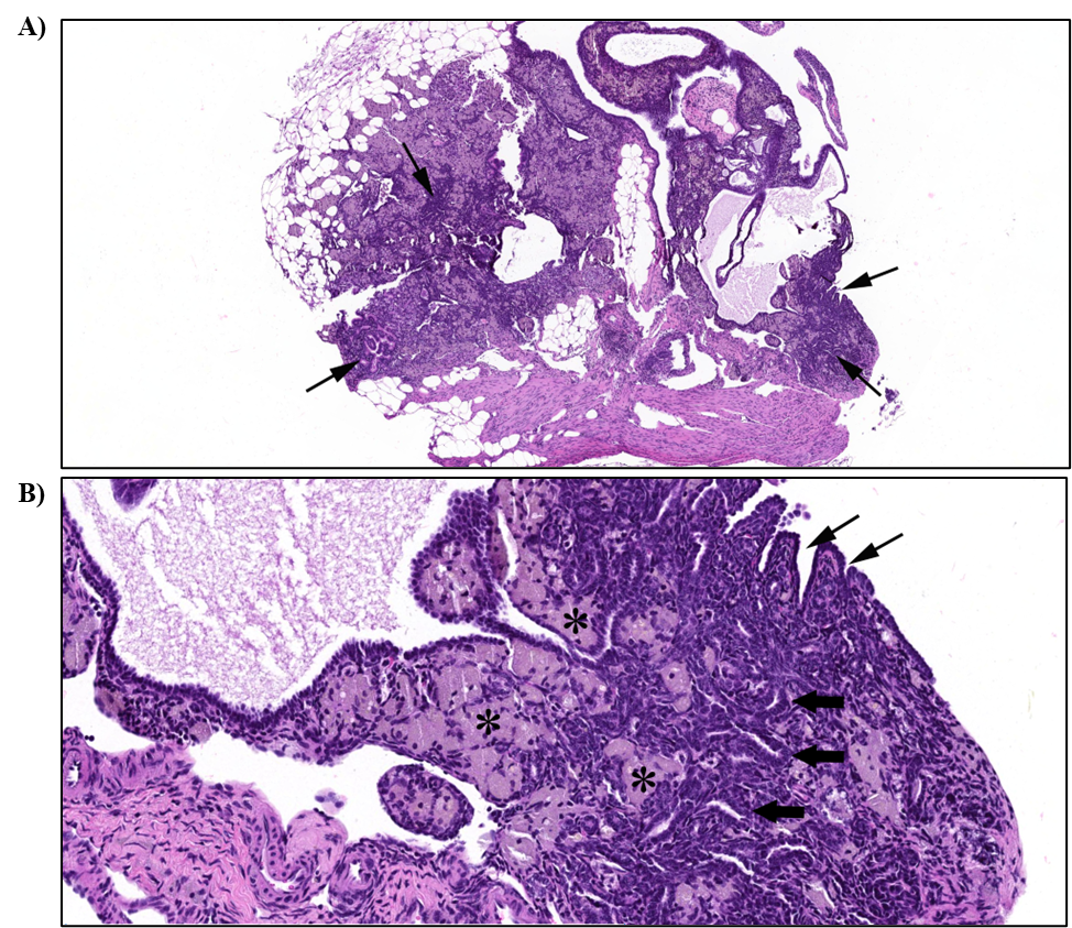 Figure 28. Representative Images of Tubulostromal Hyperplasia in the Ovary of a Female Mouse in the Two-year Inhalation Study of α-Pinene (H&E)