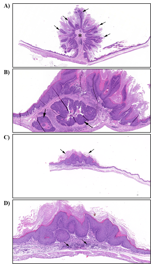 Figure 29. Representative Images of Papilloma, Squamous Cell Carcinoma, and Hyperplasia in the Forestomach of Male and Female Mice in the Two-year Inhalation Study of α-Pinene (H&E)