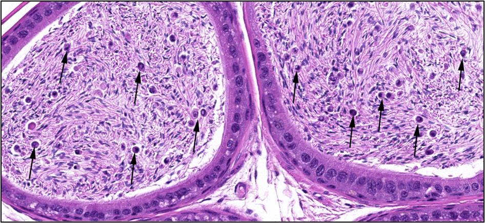 Figure 31. Representative Image of Exfoliated Germ Cells in the Epididymal Ducts in a Male Mouse in the Two-year Inhalation Study of α-Pinene (H&E)