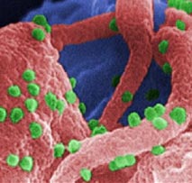 3D rendering of HIV-1 virus